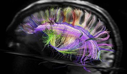 Beyni hiç böyle görmediniz