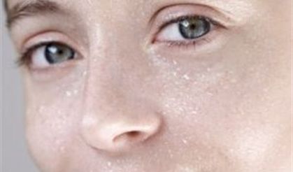 Soğukta cildiniz su kaybetmesin!