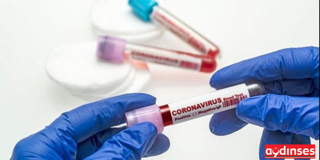 Korkutan rakam; Koronavirüs vaka sayısı 19 bine yaklaştı