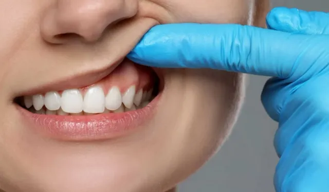 Diş eti çekiliyorsa kemik de eriyordur!